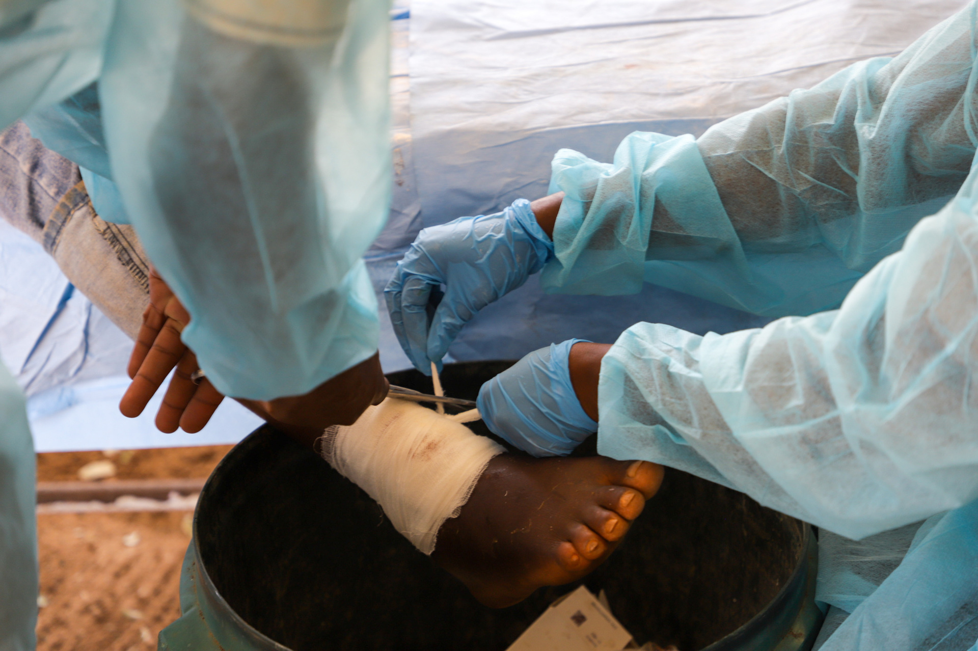 Wound management