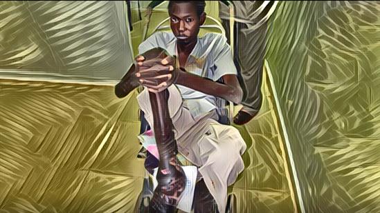 Mycetoma_4