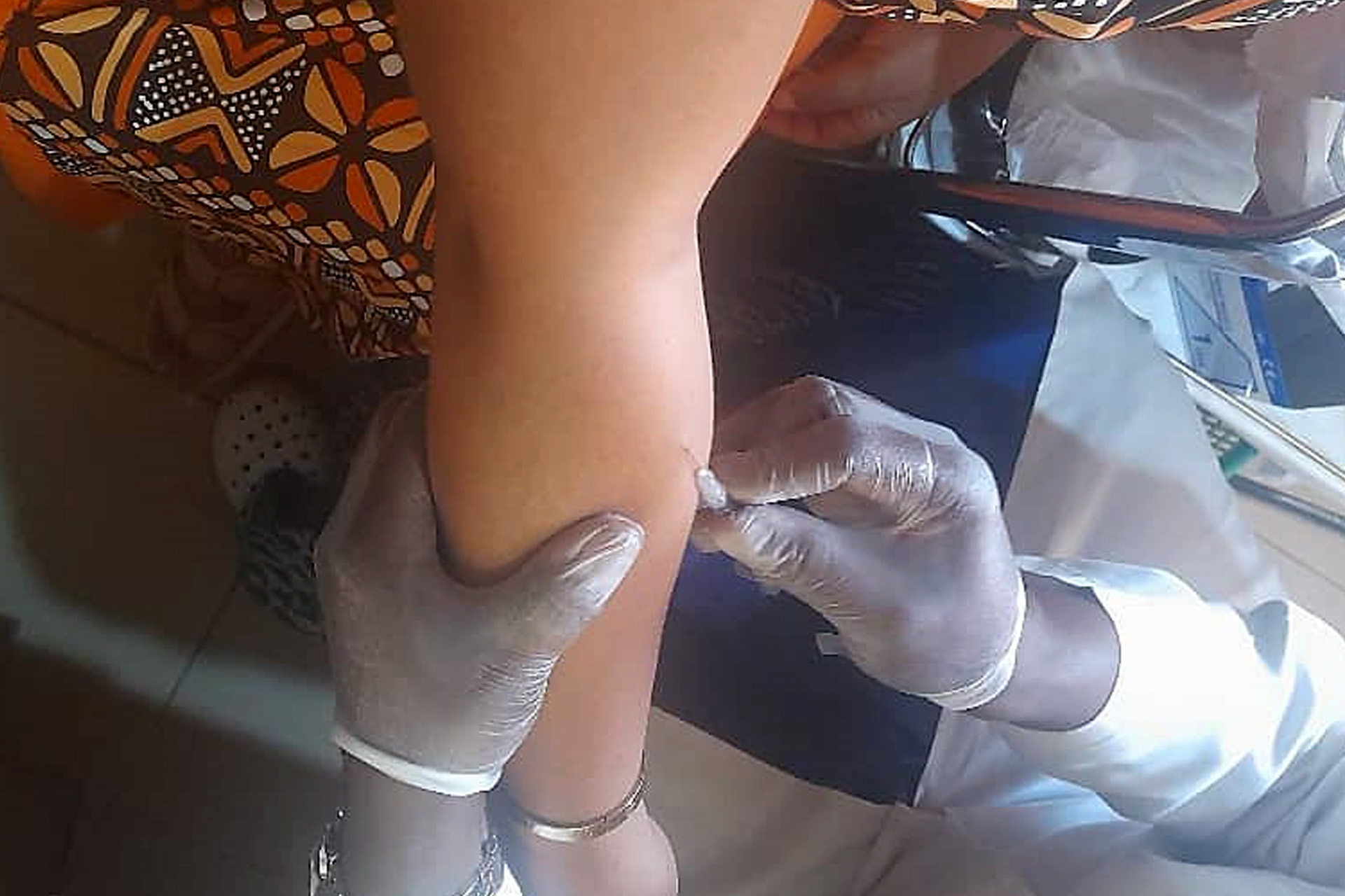 Working together for One Health in Central Africa at a rabies control training course in Cameroon 2- WHO-Deborah Nadal