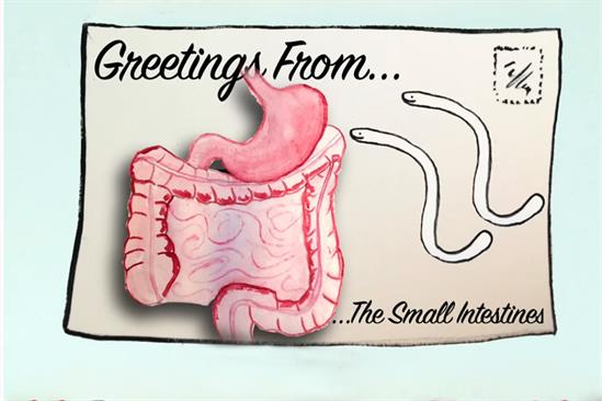 Hookworms and the Myth of the Lazy Southerner