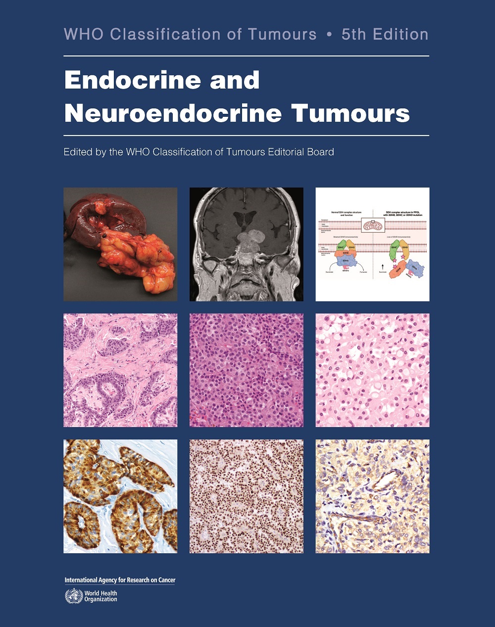 WHO-classification-tunours-5th-edition-endocrine-and-neuroendocrine-tumours-thumbnail