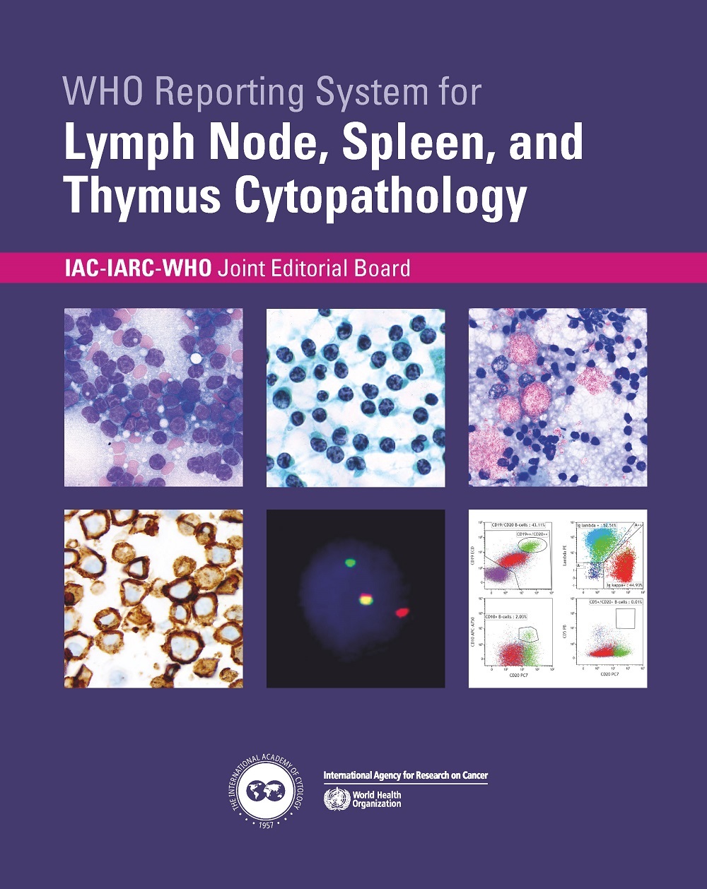WHO-reporting-system-lymp-node-spleen-thymus-cytopathology-thumbnail