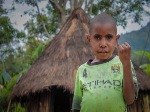 Poio-vaccine Child showing he has been vaccinated against polio